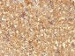  AFP (Alpha Fetoprotein) (Hepatocellular/Germ Cell Tumor Marker) Antibody - With BSA and Azide